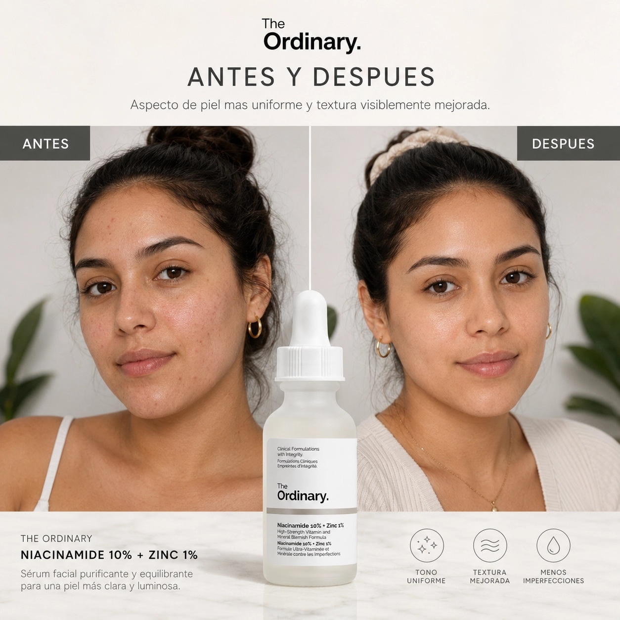 Niacinamide 10% + Zinc 1%